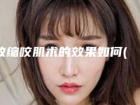 收缩咬肌术的效果如何(收缩咬肌效果好坏的因素有哪些)