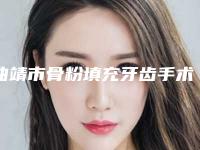 曲靖市骨粉填充牙齿手术医生排行揭晓合肥市第二人民医-曲靖市杨利平口腔医生
