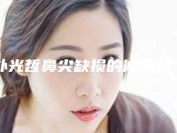 朴光哲鼻尖缺损的修复对眼睛有害吗