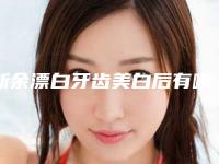 新余漂白牙齿美白后有哪些调理方法