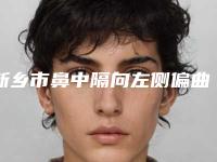 新乡市鼻中隔向左侧偏曲手术手术医院-红旗奕诺美医疗美容口碑实力均在线