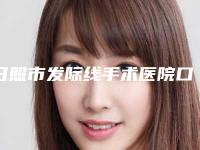 日照市发际线手术医院口碑排行名单展示（日照市发际线手术整形医院）