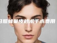 日照蜂巢皮秒术手术费用要多少