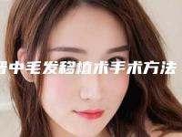 晋中毛发移植术手术方法效果好