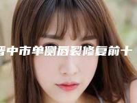 晋中市单侧唇裂修复前十个实力派你看中了哪个-戴培元医生医美5强实力口碑盘点-附价格