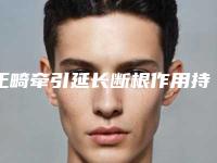 正畸牵引延长断根作用持久不-正畸牵引延长断根能够保持多久