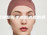 正颌整形手术后遗症的表现