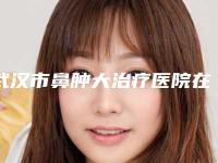 武汉市鼻肿大治疗医院在榜名单top10强全新版爆出-武汉市鼻肿大治疗整形医院