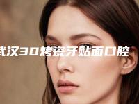 武汉3D烤瓷牙贴面口腔医院top10[武汉烤瓷牙价格]