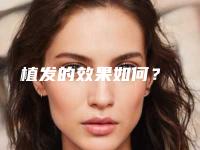 植发的效果如何?