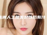 株洲人工植发对以后有什么影响吗