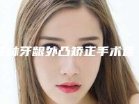 桂林牙龈外凸矫正手术适用人群及手术方法