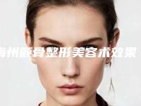 梅州颧骨整形美容术效果好不好价格是多少
