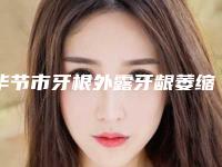 毕节市牙根外露牙龈萎缩医生在榜名单top10新版汇总-毕节市孟姗姗口腔医生