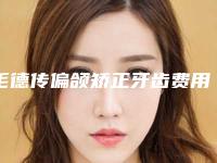 毛德传偏颌矫正牙齿费用具体是多少