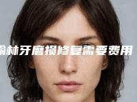 榆林牙磨损修复需要费用是多少