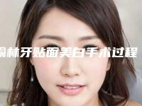 榆林牙贴面美白手术过程的风险大吗