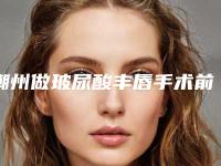 潮州做玻尿酸丰唇手术前后的效果对比