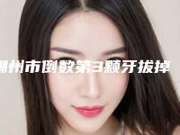 潮州市倒数第3颗牙拔掉补医生在榜名单权威筛选口碑之选-潮州市钟荣勋口腔医生