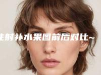 注射补水果图前后对比~补水嫩肤后QQ弹弹炒鸡舒服!