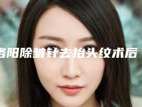 洛阳除皱针去抬头纹术后价格是多少_洛阳除皱针去抬头纹的价格怎样呢