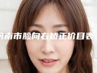 济南市脸向右矫正价目表,项目信息-中国人民解放军联勤保障部队第九六〇医院、济南军区总医院收费标准