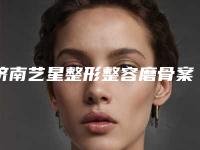 济南艺星整形整容磨骨案例品鉴-附整形价格表