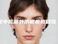 汉中脸部外伤疤痕修复完整价格表一览（汉中脸部外伤疤痕修复哪家医院好又便宜）