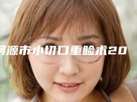 河源市小切口重睑术2025价格表(费用)明细清单一览(近6个月均价为:6632元)