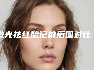 激光祛红胎记前后图对比_激光祛红胎记的危害