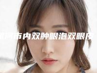 漯河市内双肿眼泡双眼皮手术医院十强一览名单公布-漯河市内双肿眼泡双眼皮手术整形医院