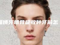 淄博牙槽骨吸收种牙前怎么做才能使效果达到最好
