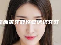 深圳市牙冠修复烤瓷牙牙科医生排名榜前十名专个盘点-刘秀兰医生收费不坑人