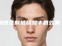 湘西注射玻尿酸丰唇效果好吗,有什么副作用吗