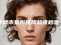 孝感市整形医院超皮秒激光手术祛斑医院(孝感市超皮秒激光手术祛斑医院排行综合实力前十了解)