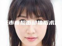 宿迁市瘦脸面部抽脂术价位表完整抢先看-宿迁市瘦脸面部抽脂术究竟需要多少费用