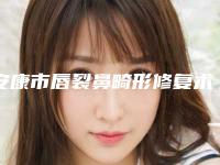 安康市唇裂鼻畸形修复术医生top10强排行榜榜单新鲜出炉-李娜医生价格超实惠