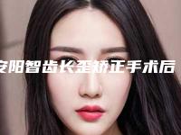 安阳智齿长歪矫正手术后期的效果自然吗