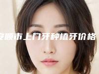 安顺市上门牙种植牙价格(费用)清单参考医生介绍专家推荐-安顺市上门牙种植牙价格