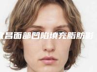 宜昌面部凹陷填充脂肪影响怀孕生孩子吗