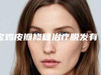 宝鸡皮瓣修复治疗脱发有没有副作用啊