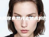 大同像素激光去皱术的作用可以持续多久