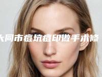 大同市痘坑痘印做手术修复医生在榜清单前十名榜单公布-刘海元整形医生超人气实力三甲医生