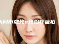 大同市激光e光治疗痤疮医院排行整形top3名声在外（大同博钰辰医疗美容诊所实力确实靠谱）