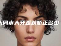 大同市大牙歪斜矫正多少钱(2025年大同市大牙歪斜矫正价格价位表2025正式发布)