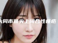 大同市额头上闭合性痤疮去除医院哪家-大同市第二人民医院广受网友好评_