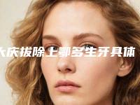 大庆拔除上鄂多生牙具体价格多少呢