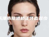 天津市隐适矫正牙齿多少钱-天津市隐适矫正牙齿医院上榜清单十强技术口碑突出