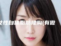女性自体脂肪隆胸(有做过自体脂肪隆胸的姐妹吗)