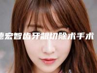 德宏智齿牙龈切除术手术的副作用是什么呢